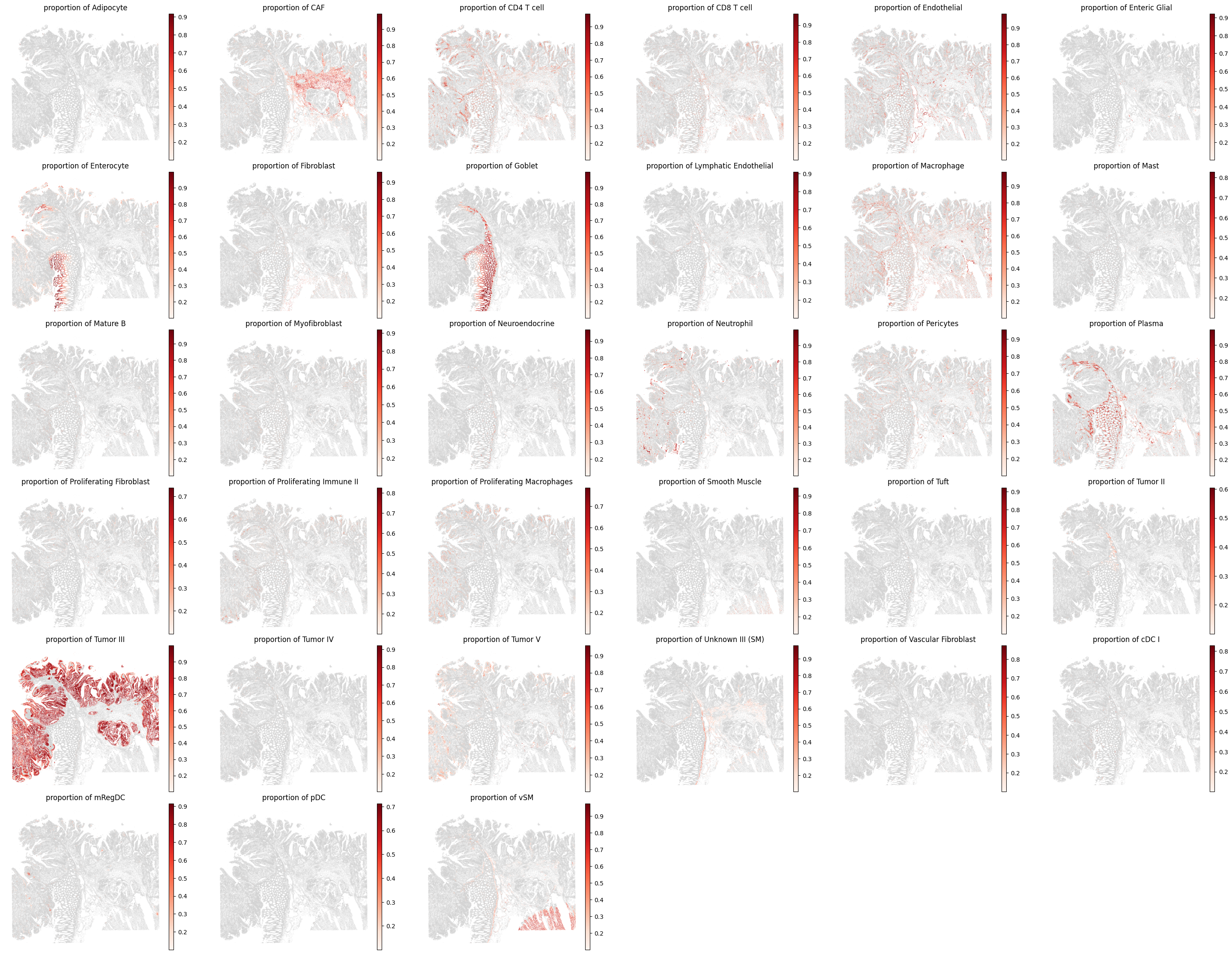../../_images/analysis_CRC_CRC_xenium_10_1.png