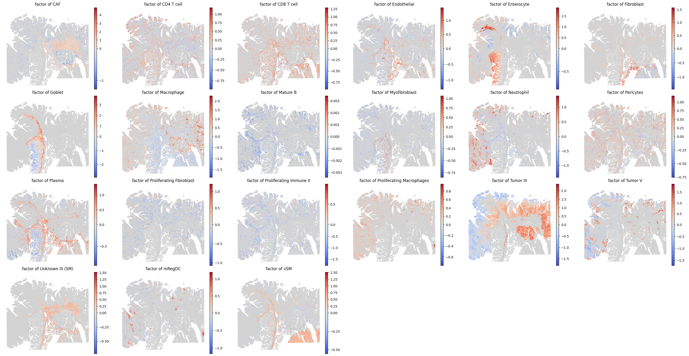 ../../_images/analysis_CRC_CRC_xenium_19_1.png