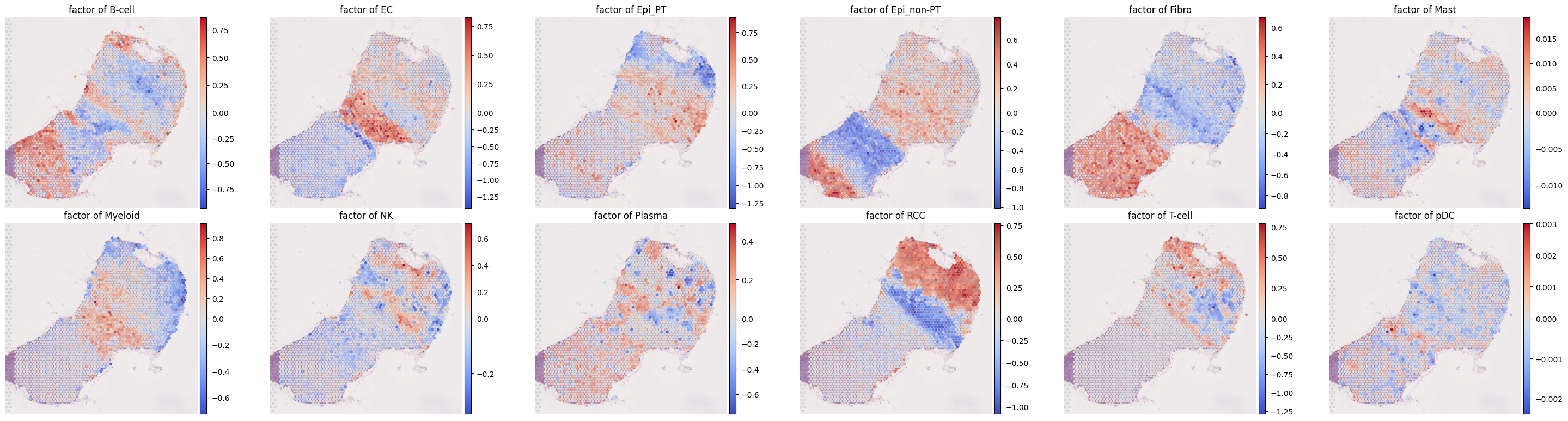 ../../_images/analysis_kidney_cancer_kidney_cancer_macsgp_5_1.png
